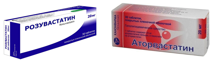 Розувастатин или аторвастатин