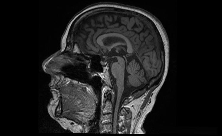 Снимок МРТ головы