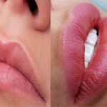 Что лучше татуаж губ или гиалуроновая кислота?